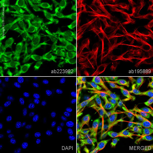 Immunocytochemistry/ Immunofluorescence - FITC Anti-VCAM1 antibody [EPR5047] (AB223982)