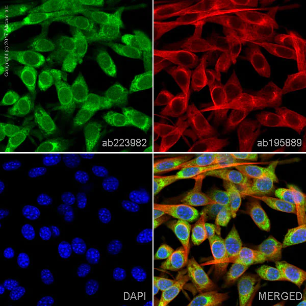 Immunocytochemistry/ Immunofluorescence - FITC Anti-VCAM1 antibody [EPR5047] (AB223982)