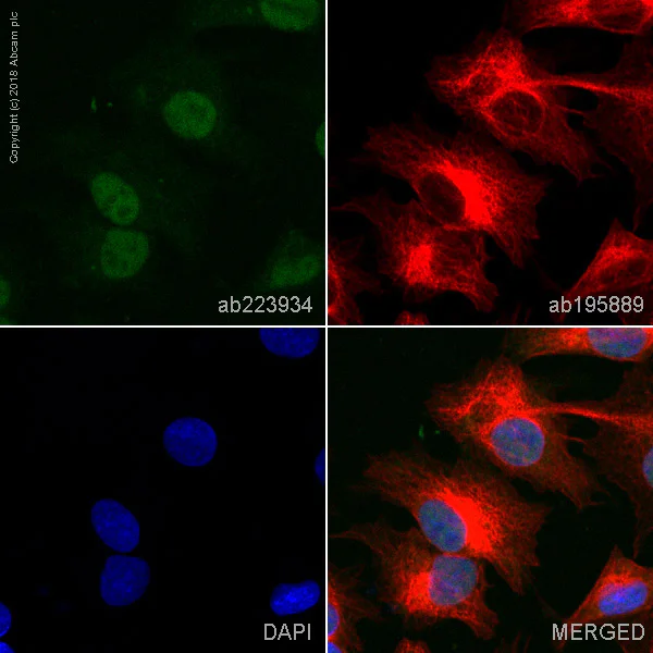 Immunocytochemistry/ Immunofluorescence - FITC Anti-Wilms Tumor Protein antibody [CAN-R9(IHC)-56-2] (AB223934)