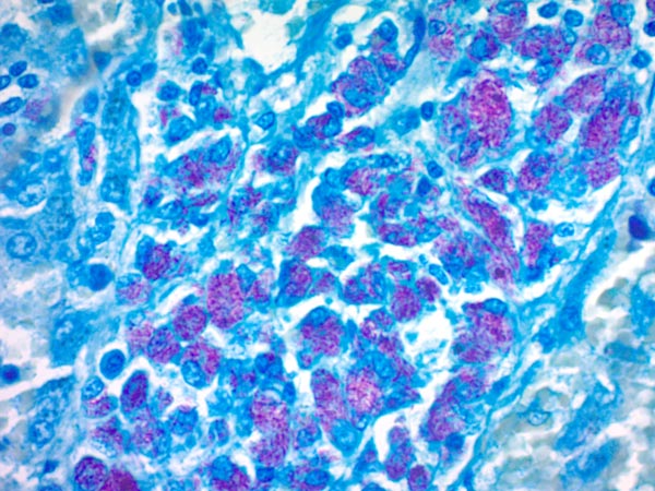 Immunohistochemistry (Formalin/PFA-fixed paraffin-embedded sections) - Fite Stain Kit (Microorganism Stain) (AB150668), expandable thumbnail