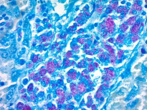 Immunohistochemistry (Formalin/PFA-fixed paraffin-embedded sections) - Fite Stain Kit (Microorganism Stain) (AB150668)
