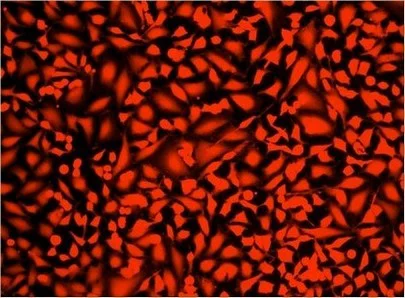 Fluorescence Microscopy - Fixable Cell Viability Assay Kit (Orange Fluorescence, for 488 nm or 561 nm excitation) (AB176743)