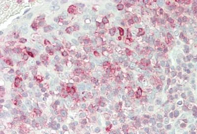 Immunohistochemistry (Formalin/PFA-fixed paraffin-embedded sections) - Anti-FKBP10 antibody (AB230852)