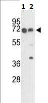 Western blot - Anti-FKBP10 antibody (AB230852)