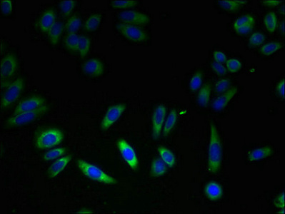 Immunocytochemistry/ Immunofluorescence - Anti-FKBP11 antibody (AB237528)