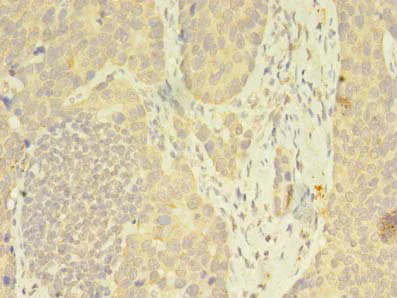 Immunohistochemistry (Formalin/PFA-fixed paraffin-embedded sections) - Anti-FKBP11 antibody (AB237528)