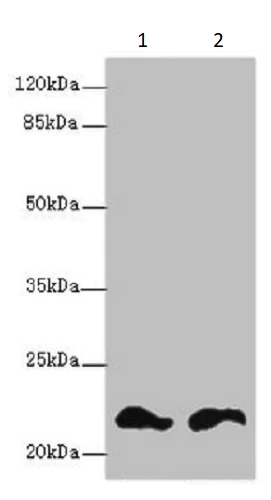 Western blot - Anti-FKBP11 antibody (AB237528)