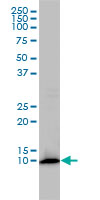 Western blot - Anti-FKBP12 antibody [1E5-A12] (AB58072), expandable thumbnail