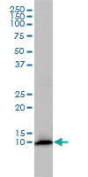 Western blot - Anti-FKBP12 antibody [1E5-A12] (AB58072)