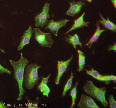 Immunocytochemistry/ Immunofluorescence - Anti-FKBP12 antibody (AB2918), expandable thumbnail