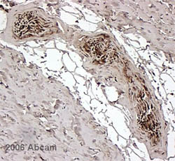 Immunohistochemistry (Formalin/PFA-fixed paraffin-embedded sections) - Anti-FKBP12 antibody (AB2918), expandable thumbnail