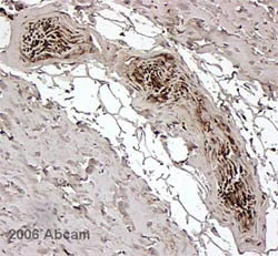 Immunohistochemistry (Formalin/PFA-fixed paraffin-embedded sections) - Anti-FKBP12 antibody (AB2918)