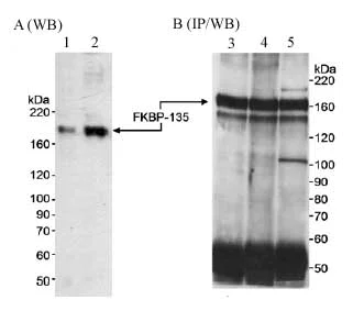 Western blot - Anti-FKBP15 antibody (AB14432)