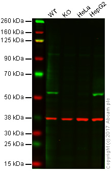Western blot - Anti-FKBP51 antibody [Hi51B] (AB79844), expandable thumbnail