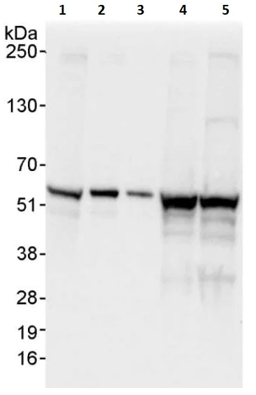 Western blot - Anti-FKBP52 antibody (AB264203)