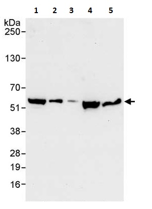 Western blot - Anti-FKBP52 antibody (AB264205), expandable thumbnail