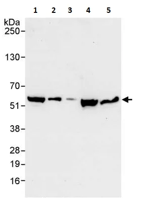 Western blot - Anti-FKBP52 antibody (AB264205)