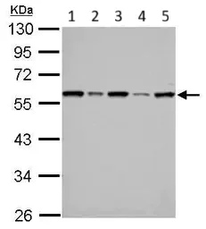 Western blot - Anti-FKBP52 antibody (AB97306)