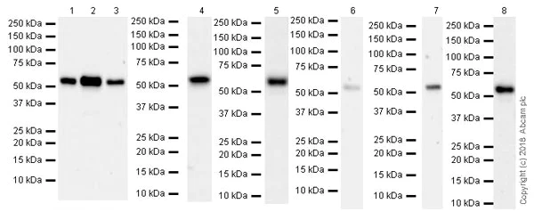 Western blot - Anti-FKBP52 antibody [EPR21120] (AB230952)