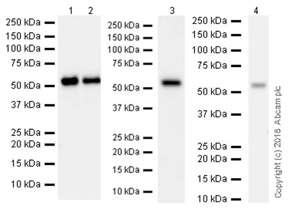 Western blot - Anti-FKBP52 antibody [EPR21125] (AB230951)