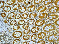 Immunohistochemistry (Formalin/PFA-fixed paraffin-embedded sections) - Anti-FKBP52 antibody [EPR6618] (AB129097)