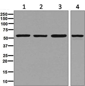 Western blot - Anti-FKBP52 antibody [EPR6618] (AB129097)