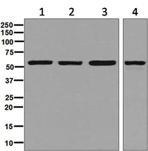 Western blot - Anti-FKBP52 antibody [EPR6618] (AB129097)