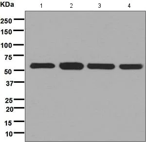 Western blot - Anti-FKBP52 antibody [EPR6619] (AB124906)