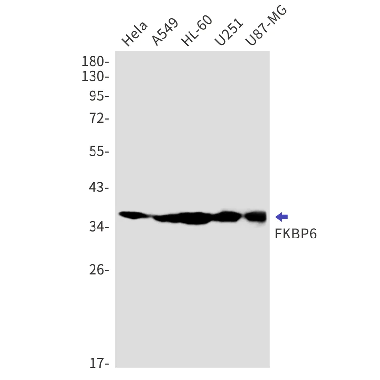 Western blot - Anti-FKBP6 Antibody [S05-4G2] (AB317425)