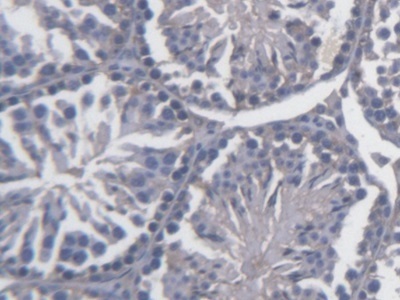 Immunohistochemistry (Formalin/PFA-fixed paraffin-embedded sections) - Anti-FKBPL antibody (AB233426)