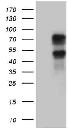 Western blot - Anti-FKLF / KLF11 antibody [OTI4H7] (AB279389)