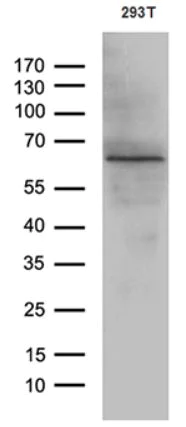 Western blot - Anti-FKLF / KLF11 antibody [OTI4H7] (AB279389)
