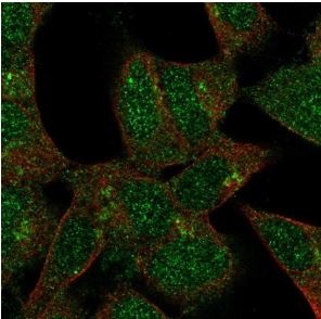Immunocytochemistry/ Immunofluorescence - Anti-FKRP antibody (AB220059)