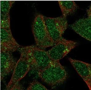 Immunocytochemistry/ Immunofluorescence - Anti-FKRP antibody (AB220059)
