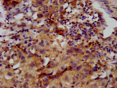Immunohistochemistry (Formalin/PFA-fixed paraffin-embedded sections) - Anti-FKRP antibody (AB238583)