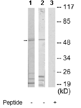Western blot - Anti-FKRP antibody (AB65243)