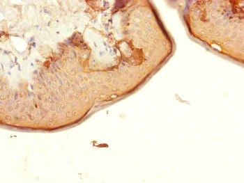 Immunohistochemistry (Formalin/PFA-fixed paraffin-embedded sections) - Anti-FKSG14/p33 antibody (AB236739)