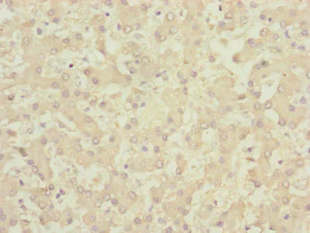 Immunohistochemistry (Formalin/PFA-fixed paraffin-embedded sections) - Anti-FKSG14/p33 antibody (AB236739)