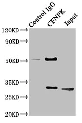Immunoprecipitation - Anti-FKSG14/p33 antibody (AB236739)