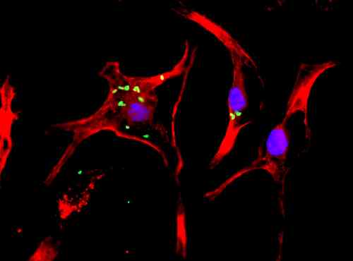 Immunocytochemistry/ Immunofluorescence - Anti-Flagellin antibody (AB93713)