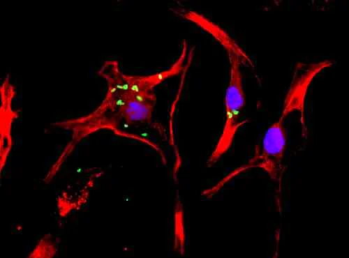 Immunocytochemistry/ Immunofluorescence - Anti-Flagellin antibody (AB93713)