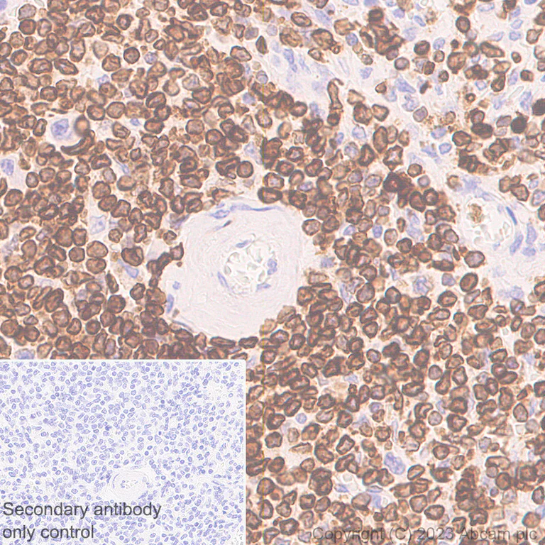 Immunohistochemistry (Formalin/PFA-fixed paraffin-embedded sections) - Anti-FLAP antibody [EPR27505-52] - BSA and Azide free (AB314653)