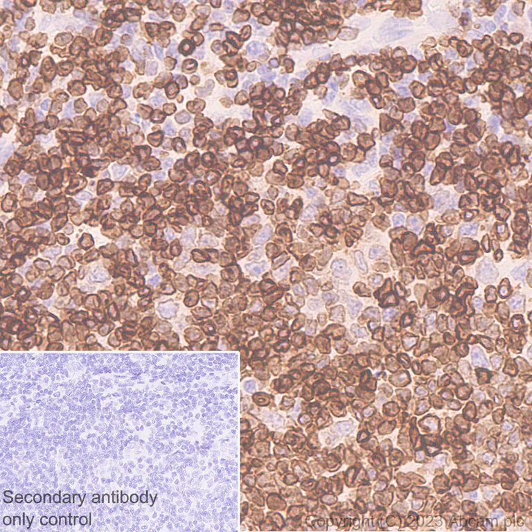 Immunohistochemistry (Formalin/PFA-fixed paraffin-embedded sections) - Anti-FLAP antibody [EPR27505-52] - BSA and Azide free (AB314653)
