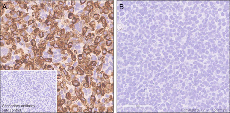 Immunohistochemistry (Formalin/PFA-fixed paraffin-embedded sections) - Anti-FLAP antibody [EPR27505-52] - BSA and Azide free (AB314653)