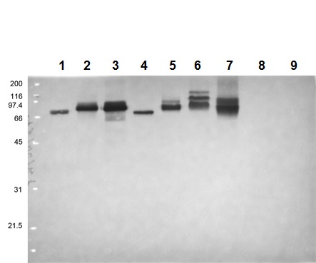 Western blot - Anti-Flavivirus NS1 antibody [D/2/D6/B7] (AB214337)