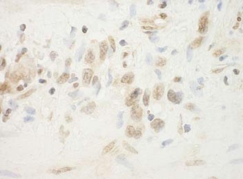Immunohistochemistry (Formalin/PFA-fixed paraffin-embedded sections) - Anti-FLCN antibody (AB176707)