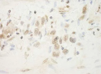 Immunohistochemistry (Formalin/PFA-fixed paraffin-embedded sections) - Anti-FLCN antibody (AB176707)