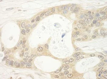 Immunohistochemistry (Formalin/PFA-fixed paraffin-embedded sections) - Anti-FLCN antibody (AB176707)