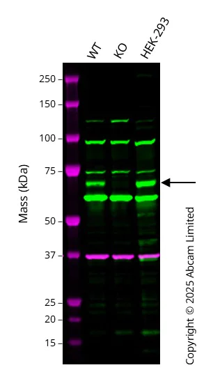 Western blot - Anti-FLCN antibody [EPNCIR147] - BSA and Azide free (AB248039)