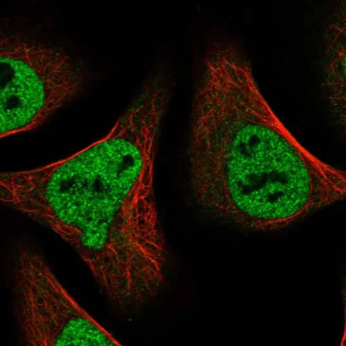 Immunocytochemistry/ Immunofluorescence - Anti-FLG2 antibody (AB122011)